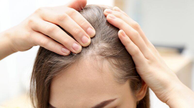 Know All About The Myths Of The Hair Loss Now