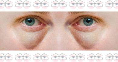 Make Tired Puffy Eyes Look Better: Know It All Now