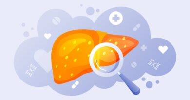 Fatty Liver: The Soaring Global Health Challenge; Know It All Here