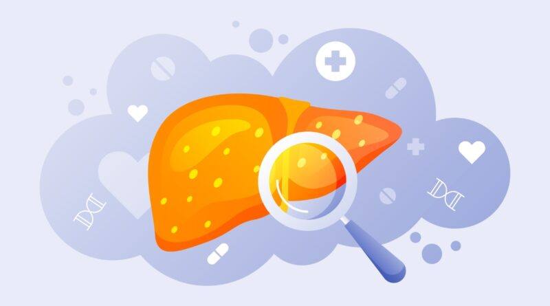 Fatty Liver: The Soaring Global Health Challenge; Know It All Here