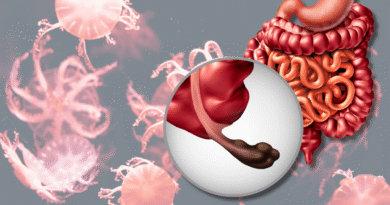 Spotlight – Colon Cancer: Know It All Here