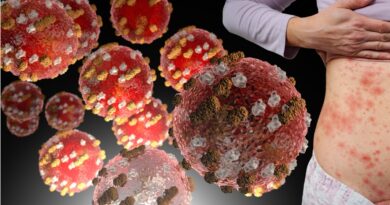 Measles Returns: The Truth We Need To Know Now
